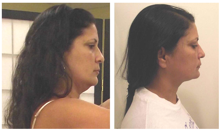 45-Year-Old Patient