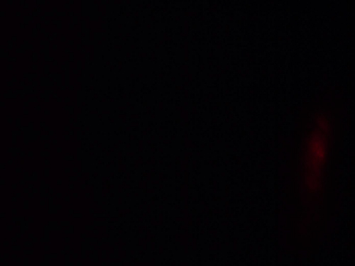 Zerona<sup>®</sup> Laser